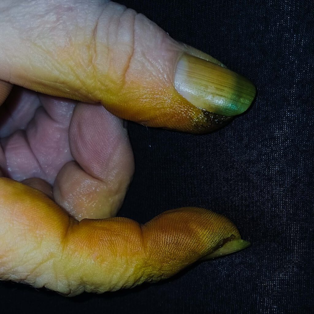 Schwarze Walnüsse Schwarze Finger